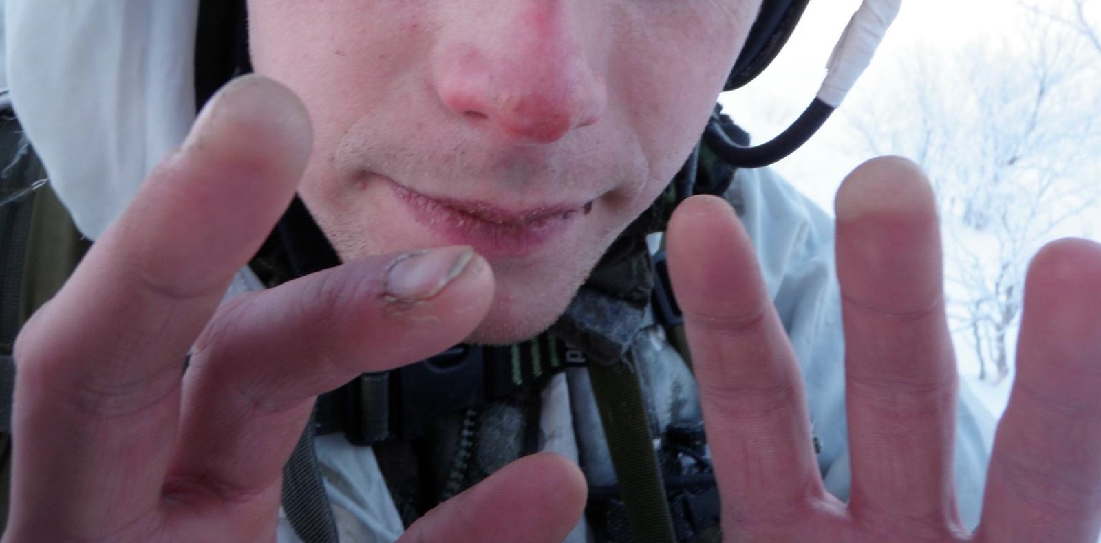 Day 1 - fingers & nose