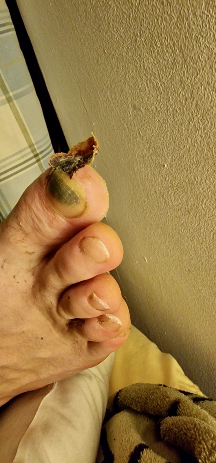 Day 28